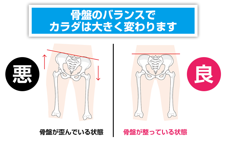 骨盤のバランス画像
